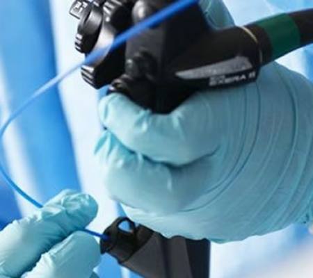COLANGIOPANCREATOGRAFIA ENDOSCOPICA RETROGRADA (CPRE) COLANGIOPANCREATOGRAFIA ENDOSCOPICA RETROGRADA (CPRE)